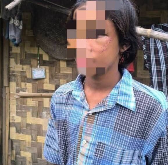 ဓာတ်ပုံ - ကျွန်းလှကန့်ဘလူ တက်ကြွလှုပ်ရှားသူများအဖွဲ့ - ကန့်ဘလူခရိုင်