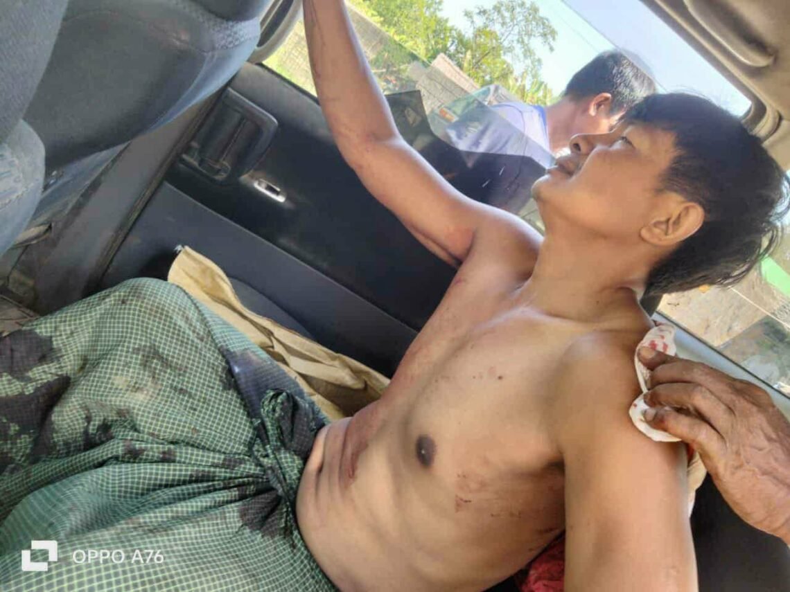 (ဓာတ်ပုံ - ပုဏ္ဏားကျွန်းမြို့နယ်၊ ပန်းနီလာရွာကို အောက်တိုဘာ ၃၁ရက်၊ ဒီနေ့စစ်ကော်မရှင်တပ်လေကြောင်းတိုက်ခိုက်လို့ ဒဏ်ရာရသွားသူ / ပေးပို့)