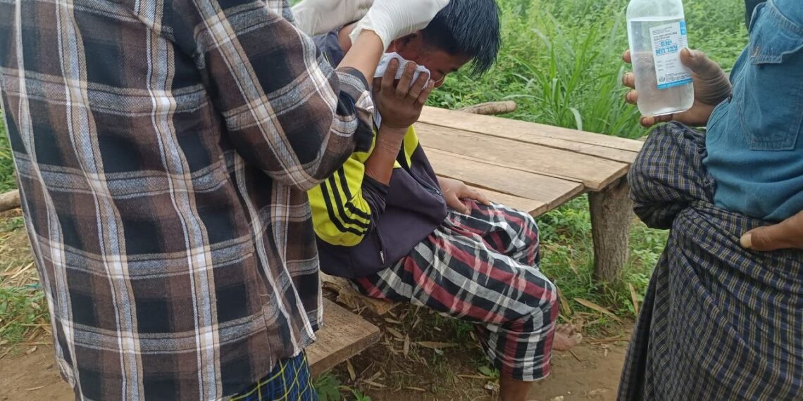 (ဓာတ်ပုံ - ထွက်ပြေးလွတ်မြောက်လာသူ ဦးကျော်မျိုး(ခ)ဦးဇင်းပြုံး / ကန့်ဘလူအမှတ် ၃ တပ်ရင်း)