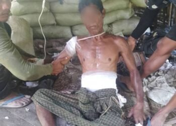 (ဓာတ်ပုံ - စစ်ကော်မရှင်တပ်လက်နက်ကြီး ကျည်စထိမှန်ခဲ့သူ / APM)