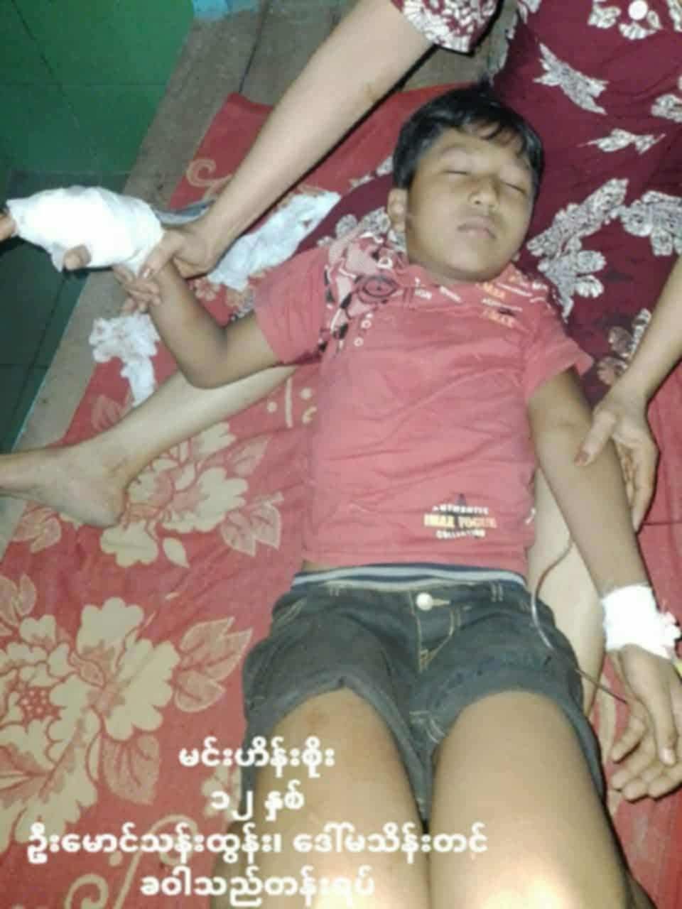 (ဓာတ်ပုံ - မင်းပြားမြို့၊ မြို့သစ်ရပ်ကွက်ကို နိုဝင်ဘာလ ၇ ရက်နေ့ညက စစ်ကော်မရှင်တပ်လေကြောင်းတိုက်ခိုက်လို့ ဒဏ်ရာရသွားတဲ့ အသက်ဆယ့်နှစ်နှစ်အရွယ်မောင်မင်းဟိန်းစိုး / ABN)