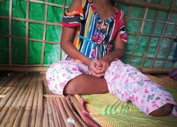 (ဓာတ်ပုံ - မြေမြုပ်မိုင်းနင်းမိလို့ ခြေထောက်တဖက်ပြတ်သွားတဲ့ မိန်းကလေးငယ်ဟာ ခြေတုတပ်ဖို့လိုအပ်နေပါတယ် / BNA)