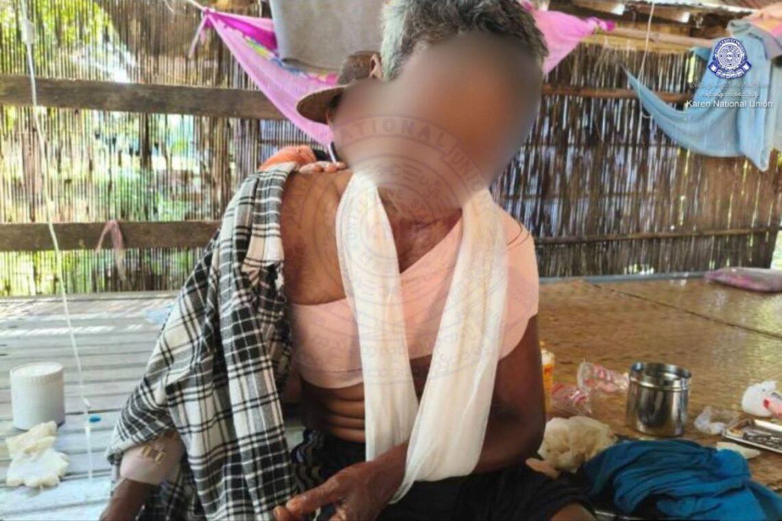 ဓာတ်ပုံ - ကရင်အမျိုးသားအစည်းအရုံး