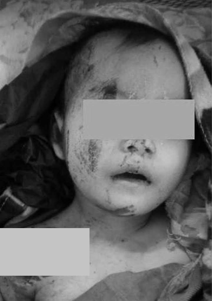 ဓာတ်ပုံ - ကရင်အမျိုးသားအစည်းအရုံး၊ မြိတ်ထားဝယ်ခရိုင်