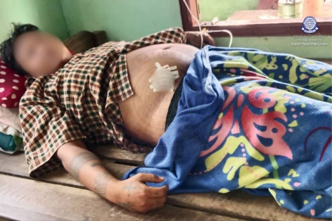ဓာတ်ပုံ-ကရင်အမျိုးသားအစည်းအရုံး