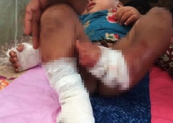 ဓာတ်ပုံ - GEM