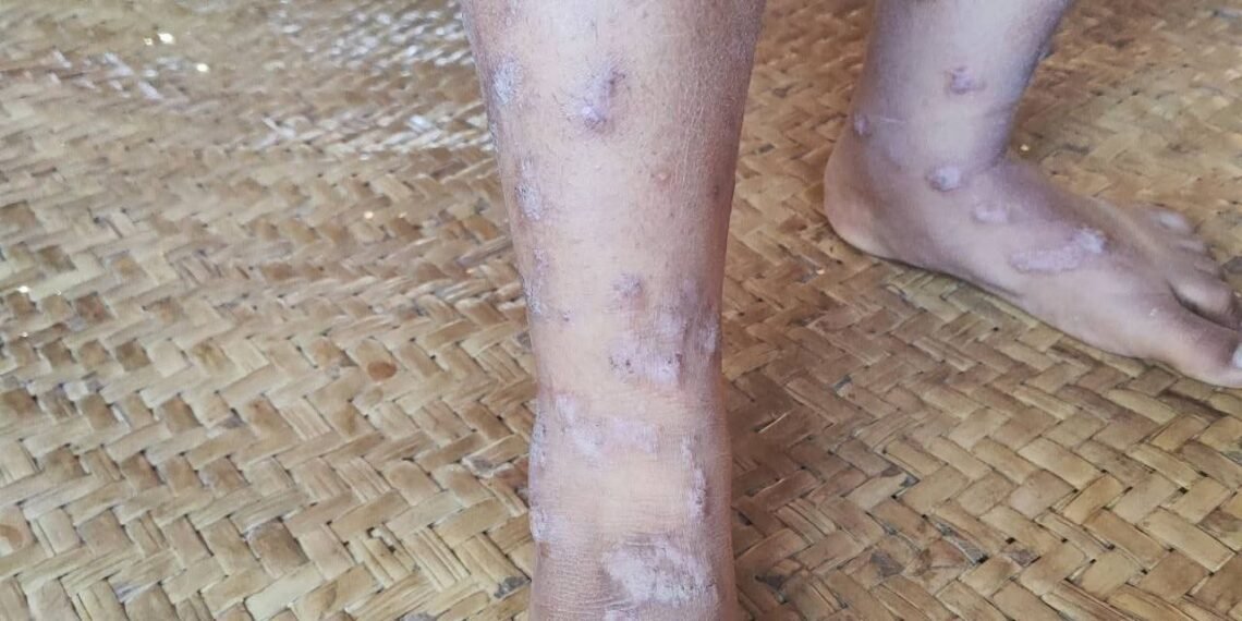 ဓာတ်ပုံ-ပေါက်မြို့နယ်ပြည်သူ့အုပ်ချုပ်ရေးအဖွဲ့ (ပအဖ)