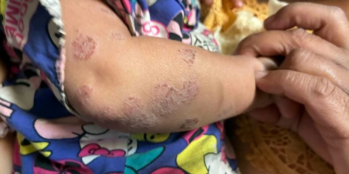 ဓာတ်ပုံ-ပြည်သူ့ညီနောင် စလင်း