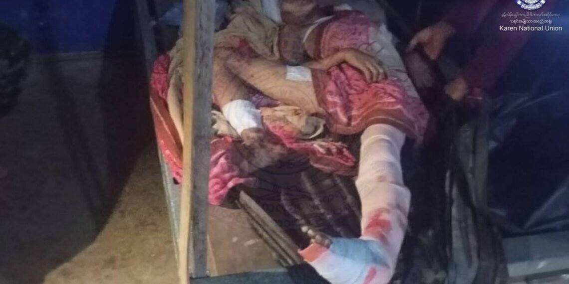 ဓာတ်ပုံ-ကရင်အမျိုးသားအစည်းအရုံး