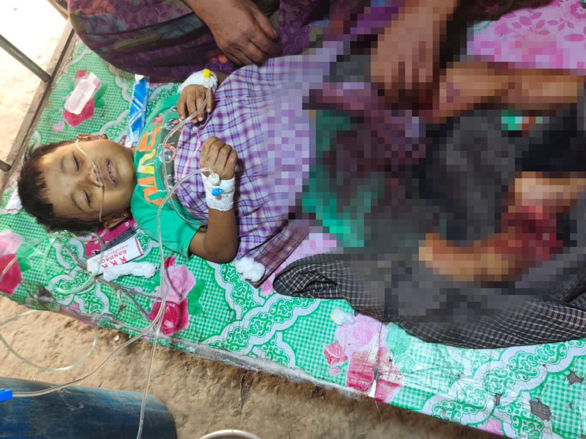 ဓာတ်ပုံ - AA