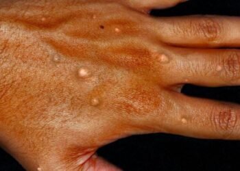 ဓာတ်ပုံ-လူမှုကွန်ရက်