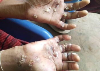 ဓာတ်ပုံ - ဒေသခံ