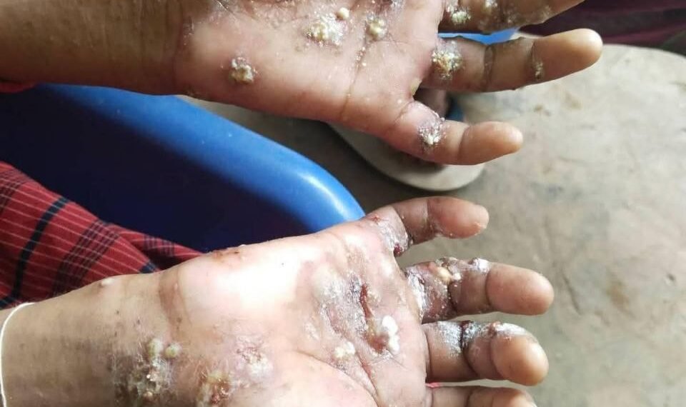 ဓာတ်ပုံ - ဒေသခံ