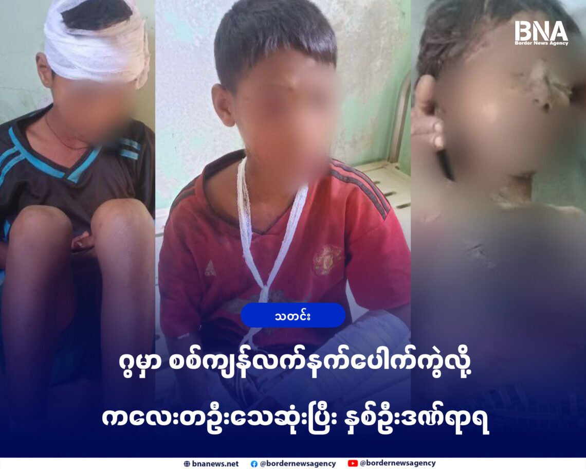 ဓာတ်ပုံ - APM