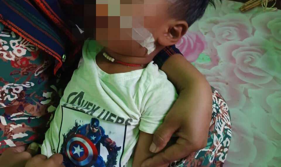 ဓာတ်ပုံ - Naw Tu Awng