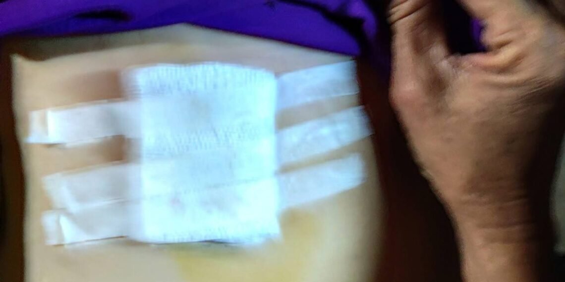 ဓာတ်ပုံ- KNU