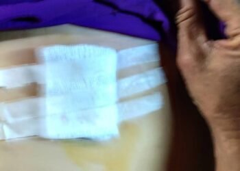 ဓာတ်ပုံ- KNU