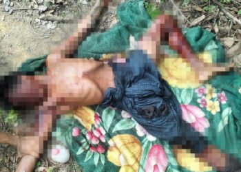 ဓာတ်ပုံ - APM