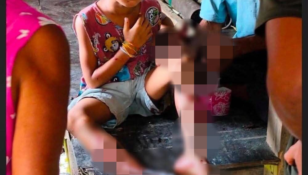 ဓာတ်ပုံ - ONN