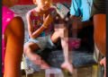 ဓာတ်ပုံ - ONN