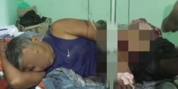 ဓာတ်ပုံ - APM