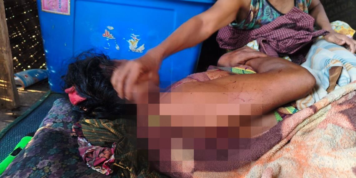 (ဓာတ်ပုံ-မြေပုံမြို့လေကြောင်းတိုက်ခိုက်ခံရပြီးနောက်တွေ့ရပုံ/BNA)